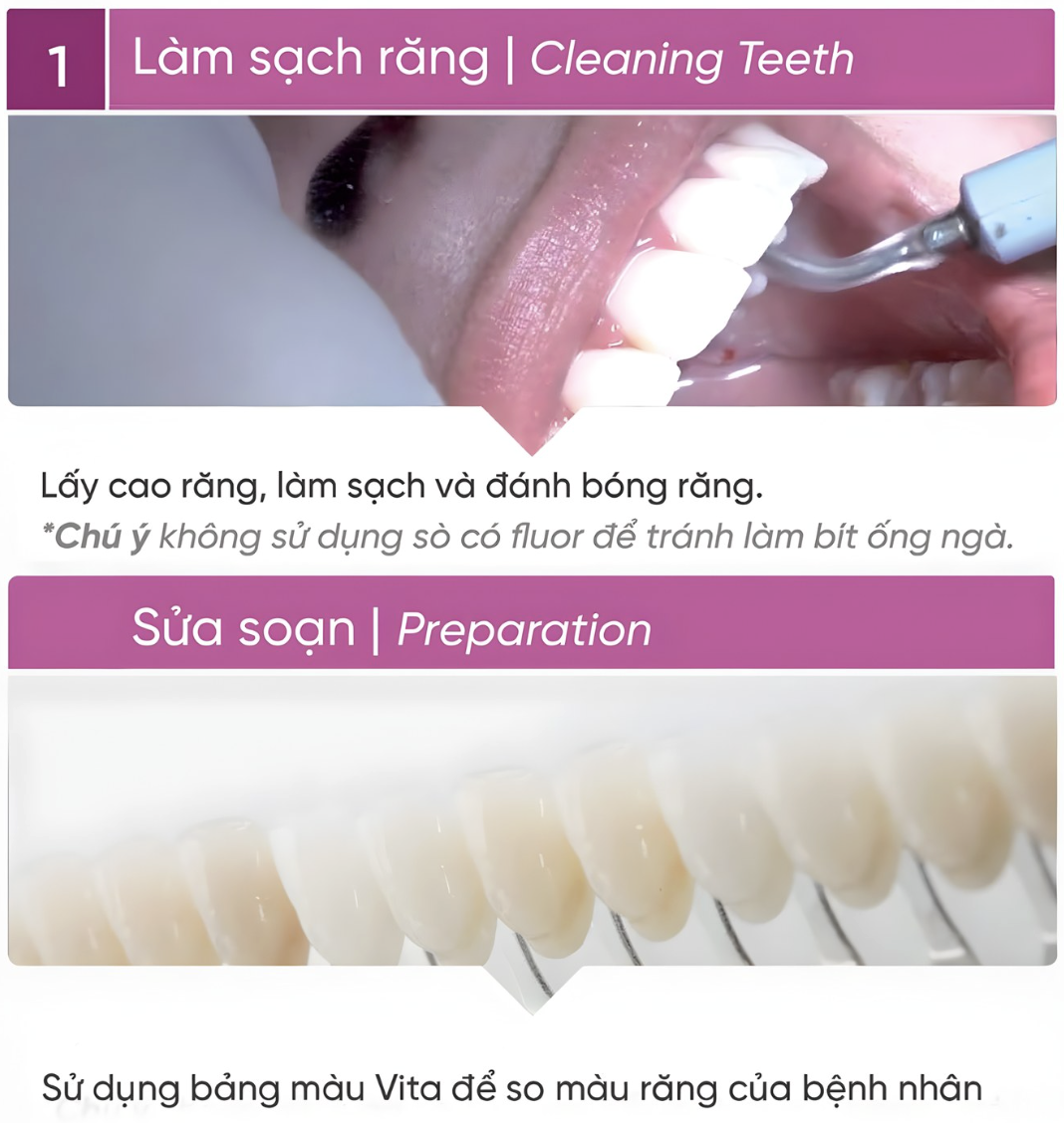 Quy trình tẩy trắng răng🌱không cần chiếu đèn Mani Bleach&rsquo;n Shine🌱NHA KHOA MALL🌱